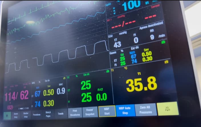 Adaptive Support Ventilation (ASV): Learn & Earn AARC-Approved CEUs Image