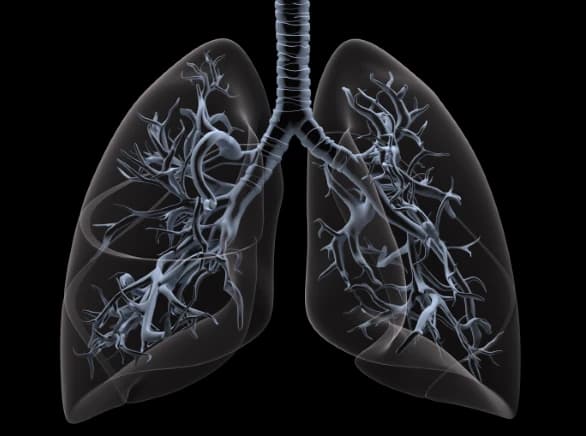Understanding and Managing Bronchopulmonary Dysplasia: Prevention and Treatment Approaches Image