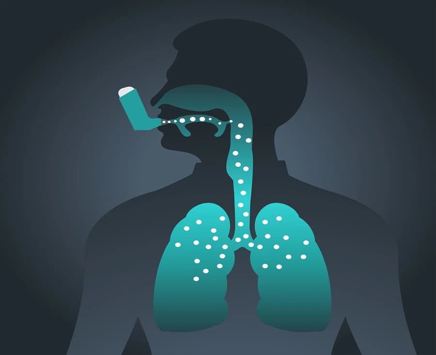 Asthma: A Brief Overview Of The Chronic Lung Condition Image